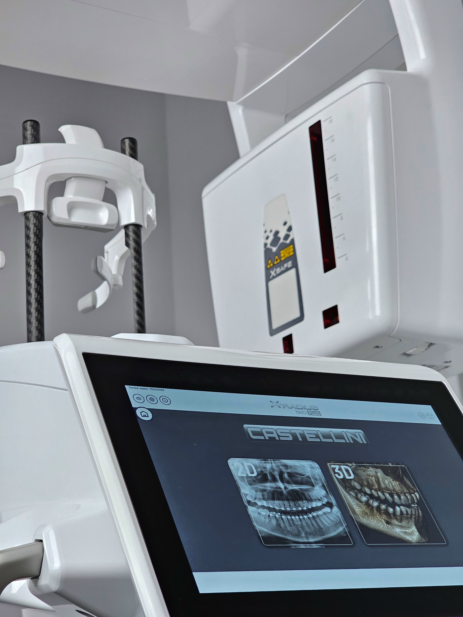 3D снимки челюсти на аппарате КТ